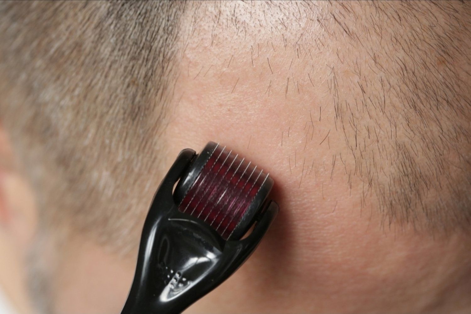 7 Weeks Professional Hair Recovery Program SP55 Silver Kit 06.jpg