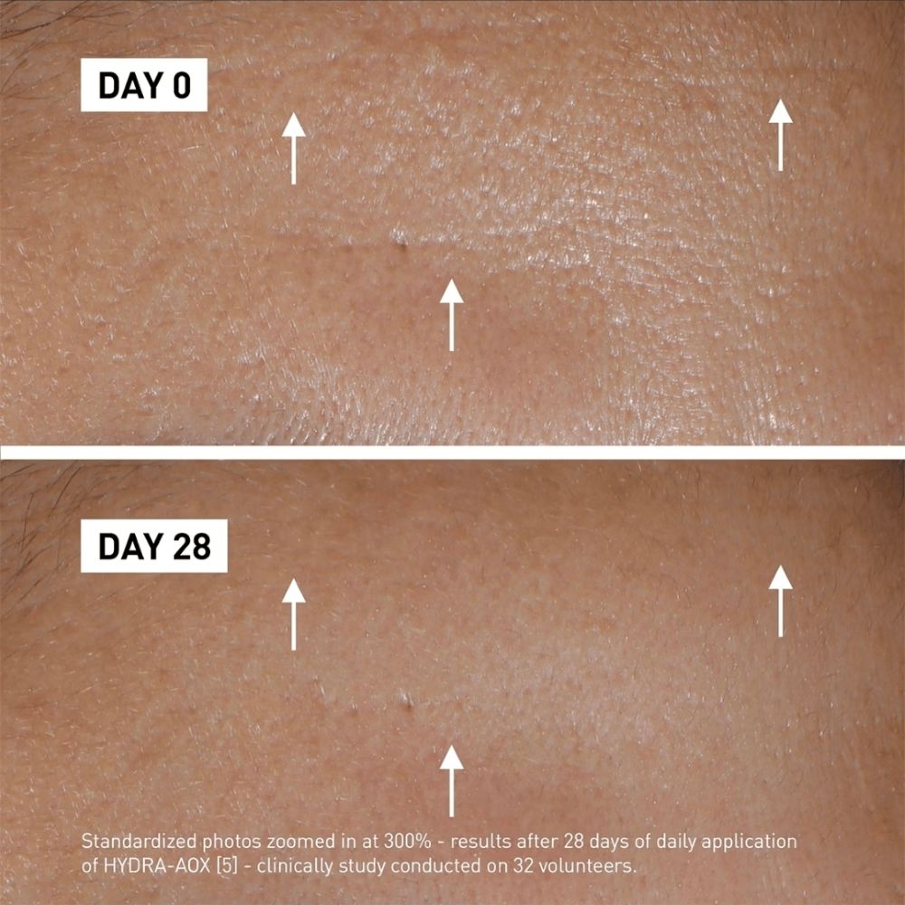 Filorga Hydra AOX5 9.jpg